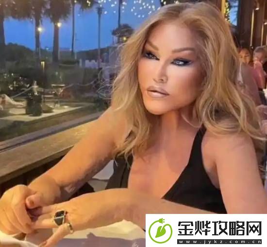 整容成“猫女”的瑞士名媛因心脏衰竭去世享年84岁
